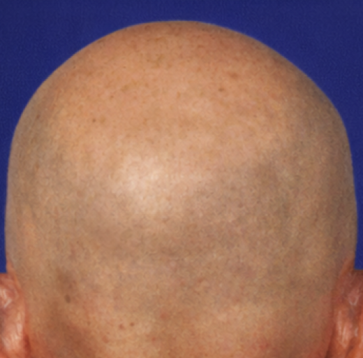 Before/After Image